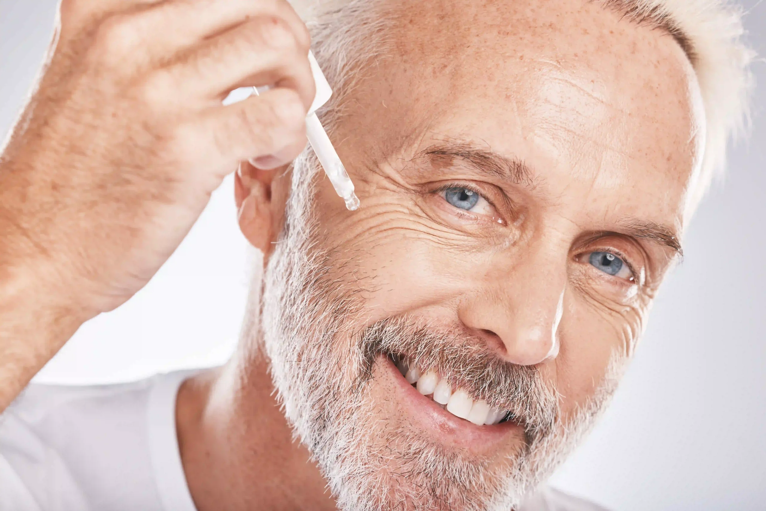 Crow’s Feet Microneedling