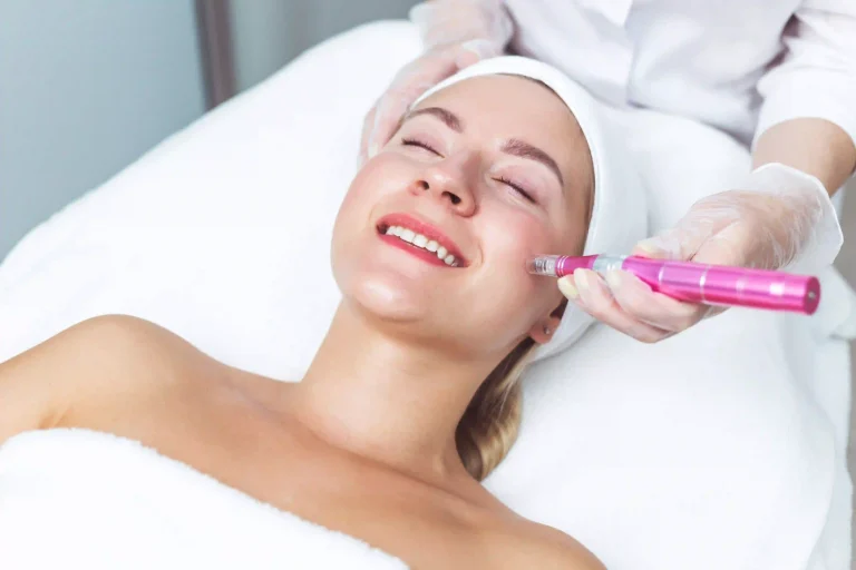 Microneedling RadioFrequency and Pen