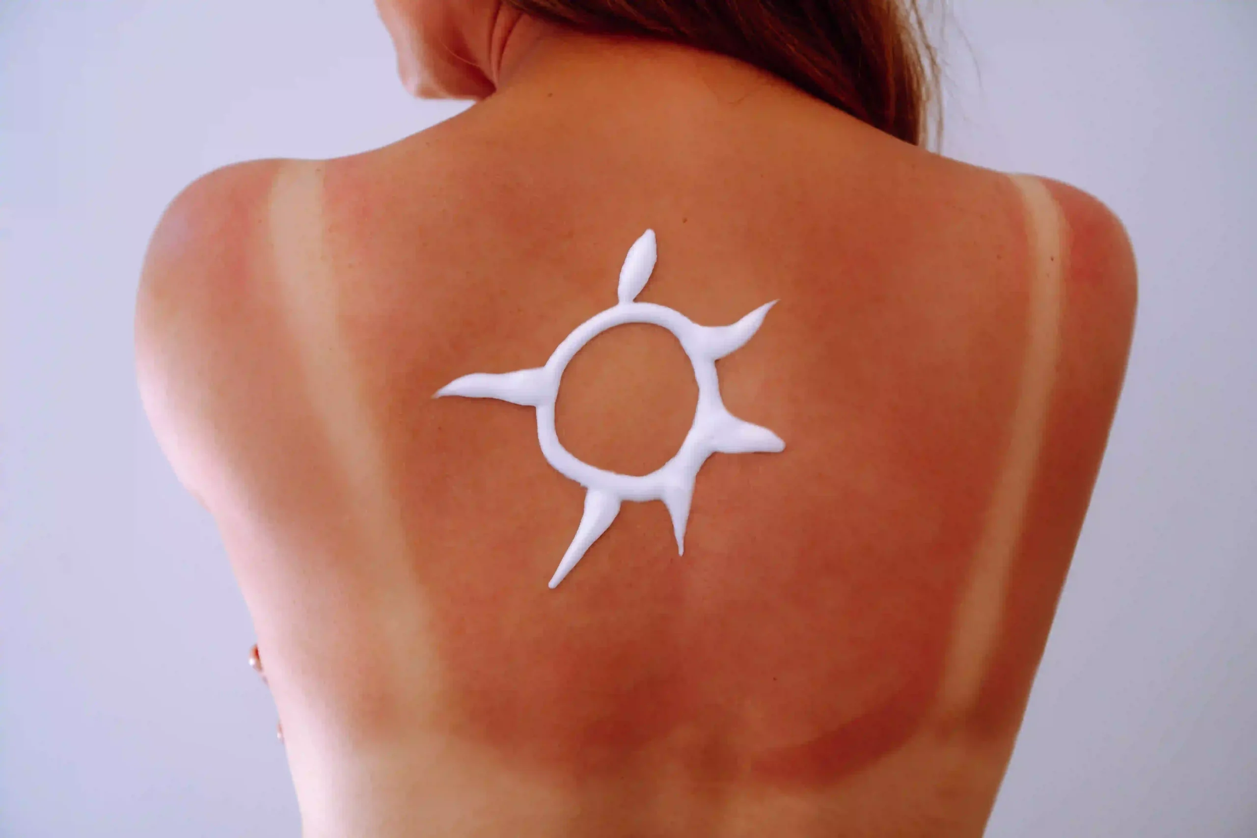 Sun Damage Repair at TrueCare Medical for Skin Renewal