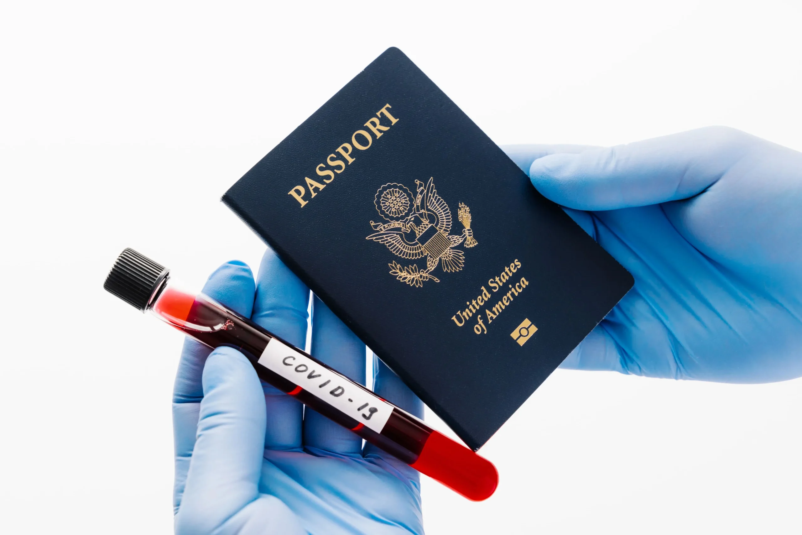 USCIS immigration medical exam, I 693