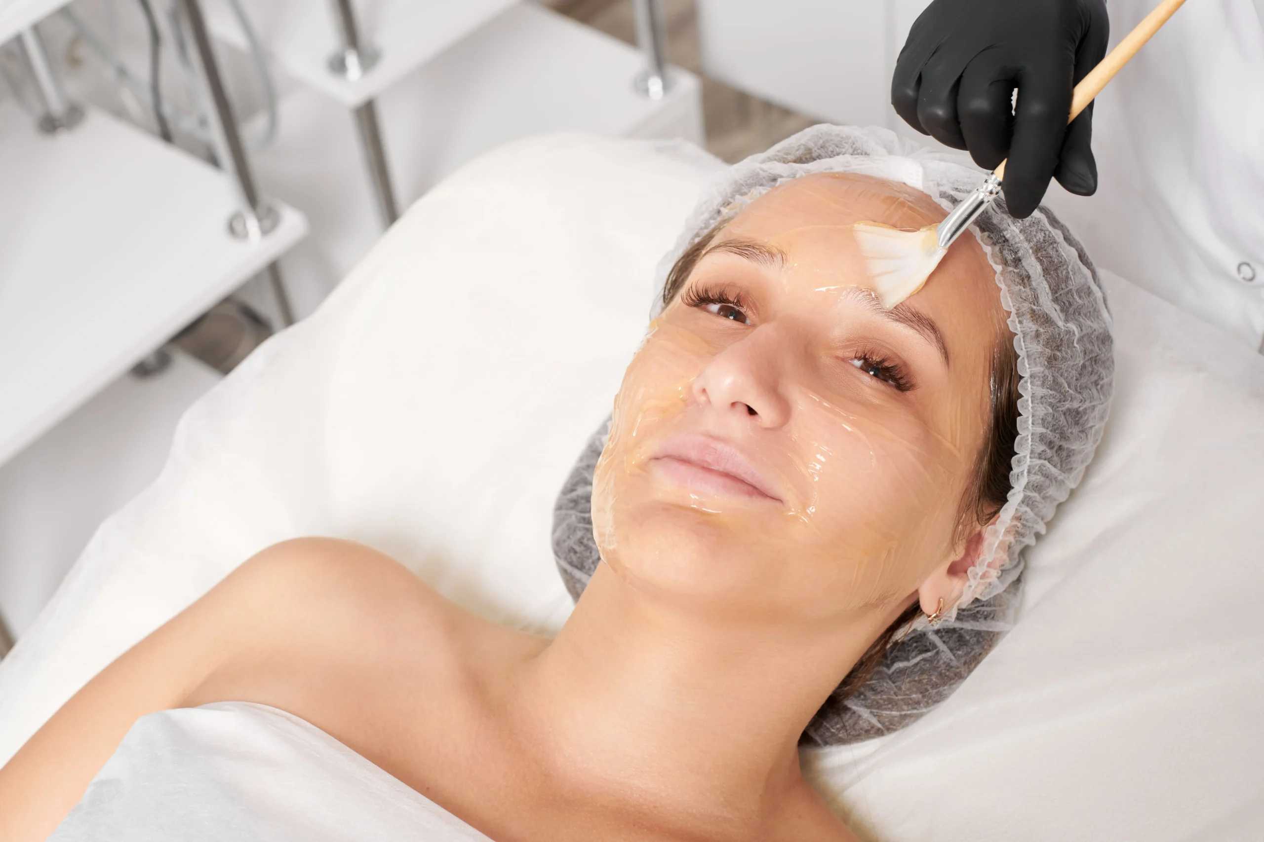 Chemical Peel vs Microneedling, skin rejuvenation