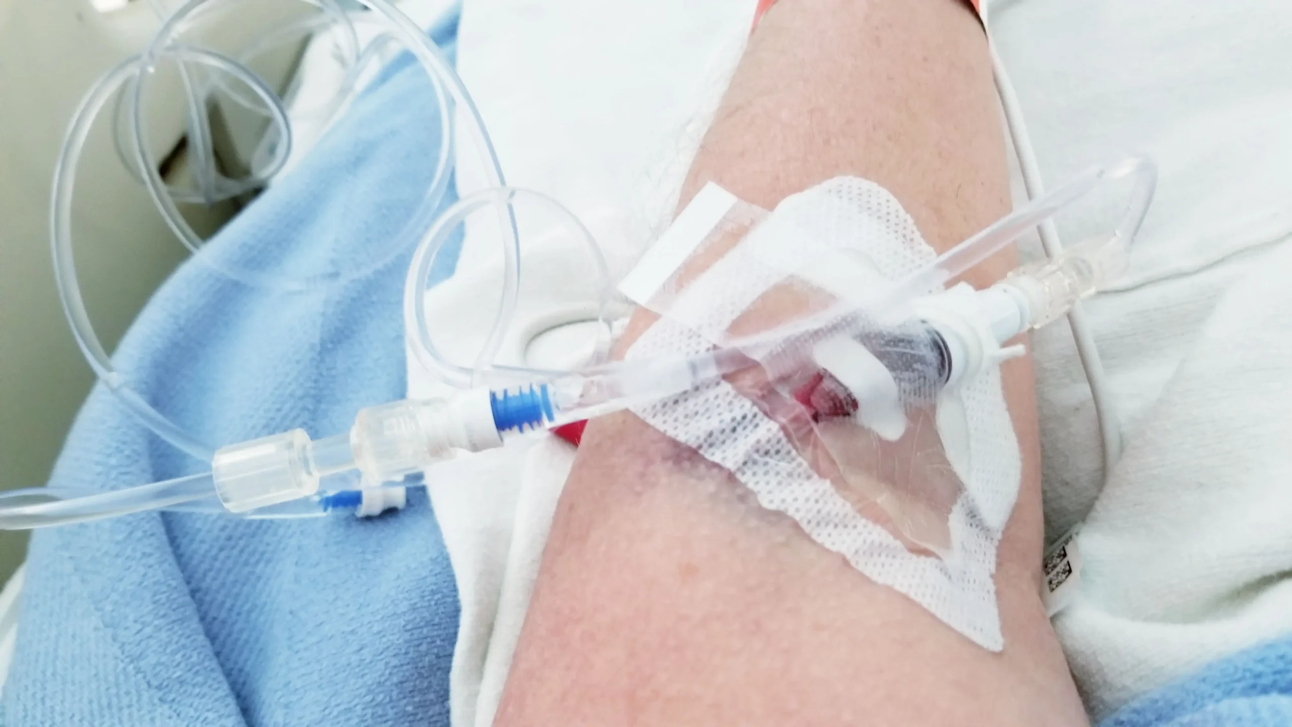 IV Therapy for cold and flu, iv therapy for colds, iv therapy